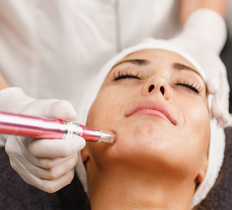 Microneedling en Tunisie