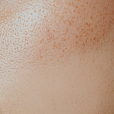 Texture irrégulière